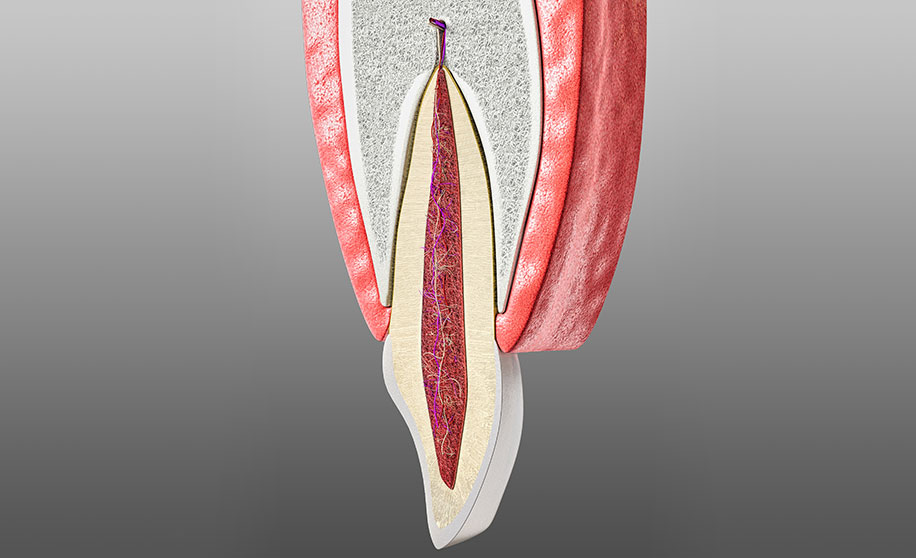 歯周組織の再生療法